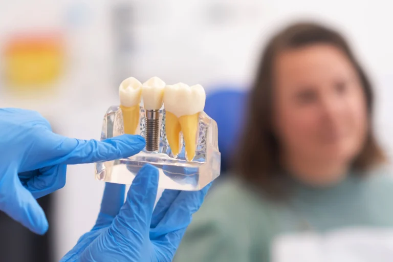 Are Dental Implants Worth the Investment What Patients Should Know los angeles dental clinic chihuahua